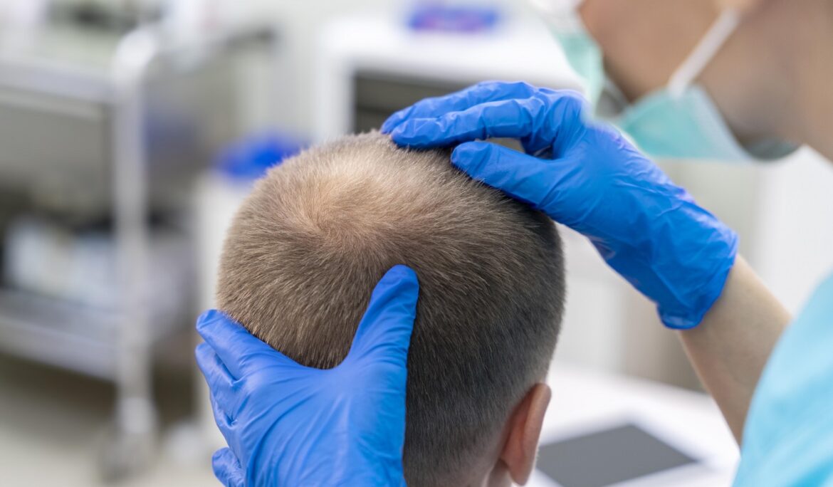 Hair Transplant
